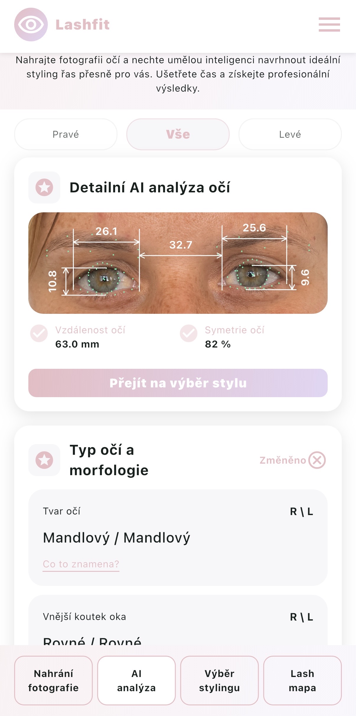AI analýza