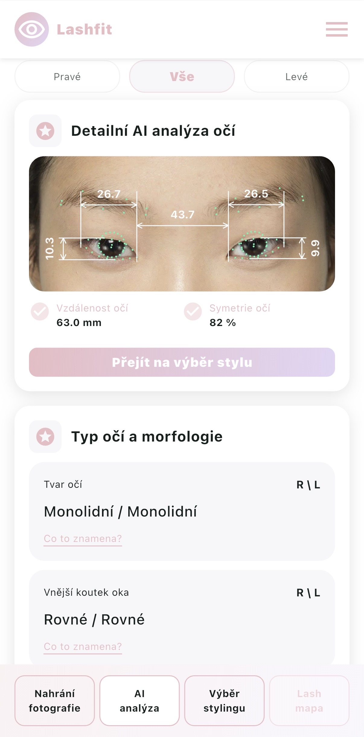 AI analýza